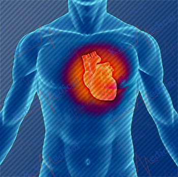 Лчение Аритмии в Израиле